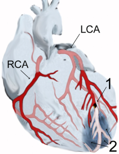 Facts about Heart Disease