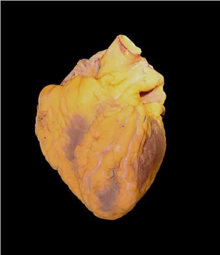 Heart Facts