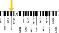 10 Interesting Facts about Werner Syndrome