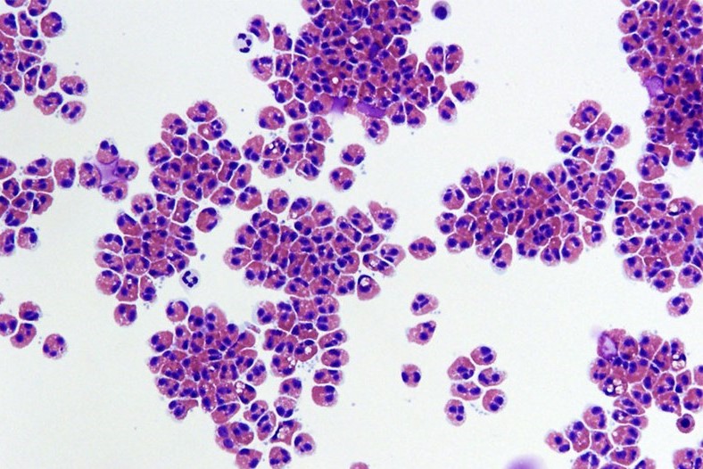 Human Eosinophils White Blood Cells